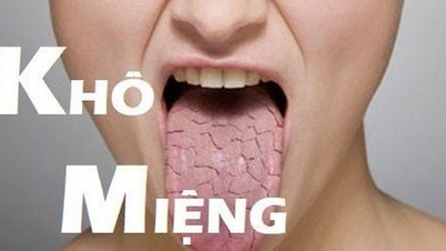 Mulut kering pada lansia, apa yang harus dilakukan untuk memperbaikinya?