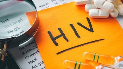 Para ahli menunjukkan cara mencegah penyakit tidak menular bagi penderita HIV
