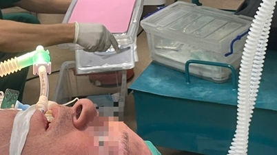 原因不明の嗄声を患っていたオランダ人男性は、1年間嗄声が続いた後、ベトナム人医師から喉頭肉芽腫と診断された。