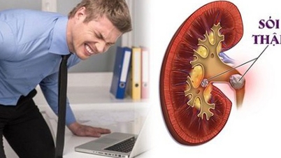 Vorbeugung von Rückenschmerzen, Harninkontinenz und Nierensteinen