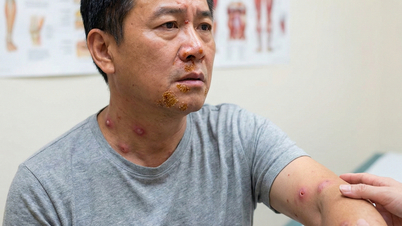 बाढ़ का पानी कम होने पर होने वाली सामान्य बीमारियाँ