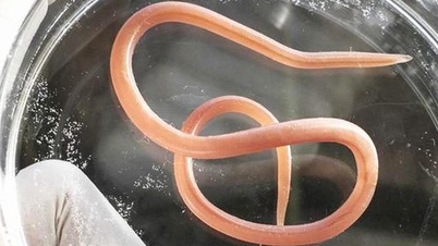 Jaké nemoci způsobuje škrkavka u lidí? Kam se obrátit na vyšetření?