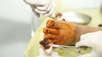 Багато людей у ​​постраждалих від повені районах страждають від хронічних захворювань, шкірних захворювань та розладів травлення.