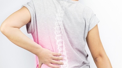 ใครบ้างที่มีความเสี่ยงต่อการเกิดอาการปวดเส้นประสาทระหว่างซี่โครง?