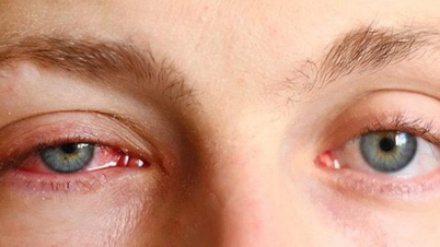 Je uveitida nebezpečná?