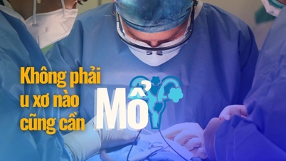 दर्द निवारक सर्जिकल तकनीक, 2 घंटे में बड़े गर्भाशय फाइब्रॉएड का इलाज करती है