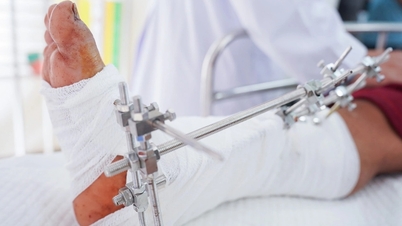 HCMC: Banyak orang mengalami kecelakaan yang mengakibatkan anggota tubuh putus dan kaki remuk.