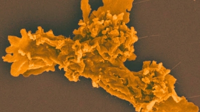 Neuer Organismus entdeckt, der bei 63°C gedeiht