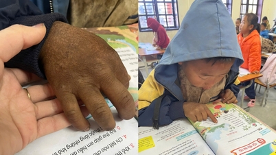 The image of the chapped hands of an 8-year-old boy in the highlands makes millions of people choke up.