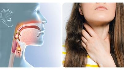 Could a sore throat be a sign of nasopharyngeal cancer?