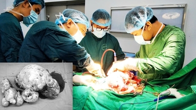 Descoberta inesperada de tumor ovariano após traumatismo cranioencefálico