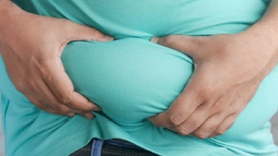 Die WHO veröffentlicht die ersten globalen Richtlinien zu Medikamenten gegen Fettleibigkeit.