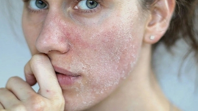 Thận yếu da có thể xuất hiện 6 triệu chứng lạ mà quen này