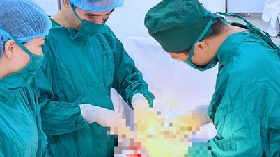 عملية جراحية في وقت متأخر من الليل تنقذ حياة امرأة تعاني من تمزق الحمل خارج الرحم وانهيار الدورة الدموية