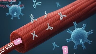 স্পাইনাল ডিকম্প্রেশন থেরাপি - অটোইমিউন র্যাবডোমাইলোসিস রোগীদের পুনরুদ্ধারে সহায়তা করে