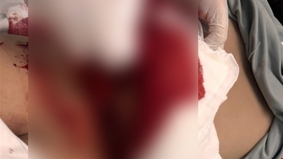 ក្មេង​ប្រុស​រង​របួស​ធ្ងន់​ធ្ងរ​បាក់​បង្គន់