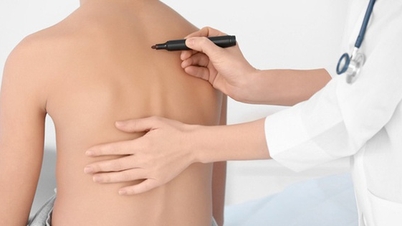 เมื่อลูกหลังค่อม กระดูกสันหลังคด จากการใช้โทรศัพท์มากเกินไป ควรทำอย่างไร?