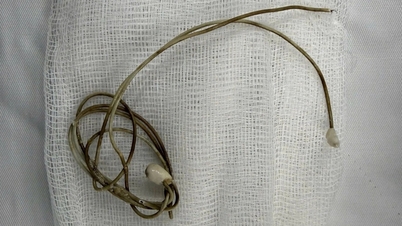 Bexiga de estudante de 16 anos encontrada junto com o cabo do carregador