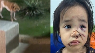 Ένα 5χρονο κορίτσι δάγκωσε σκύλος ενώ έπαιζε στο πάρκο, προκαλώντας του σοβαρά τραύματα.