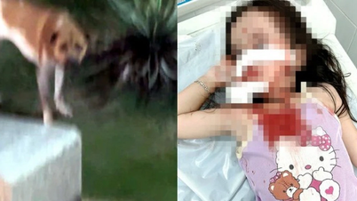 हो ची मिन्ह सिटी: 4 साल की बच्ची पर कुत्ते ने किया हमला, चेहरे पर गंभीर चोटें