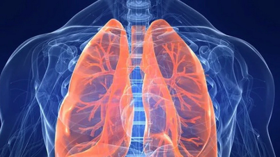 ອາຫານທີ່ຊ່ວຍເຮັດຄວາມສະອາດປອດໄດ້ຫຼາຍທີ່ທ່ານກິນ