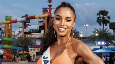 Kemalangan Miss Universe: Peserta Belum Keluar Hospital, Mengalami Cedera Tengkorak