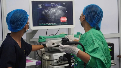 علاج ناجح لتكيس البنكرياس الكاذب باستخدام تقنية وضع الدعامة LAMS بالموجات فوق الصوتية بالمنظار