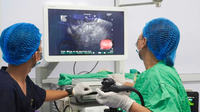 Successful treatment of pancreatic pseudocyst with the first LAMS stent in the Mekong Delta