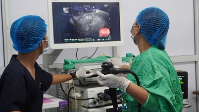 Po raz pierwszy w regionie Delty Mekongu zastosowano stenty LAMS w leczeniu pseudotorbieli trzustki.