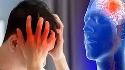 Hogyan előzzük meg a stroke-ot télen.