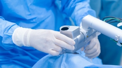 Sikeres szaruhártya-transzplantáció lézerrel a manuális módszerek helyett.