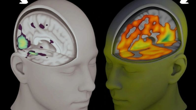 مصنوعی ذہانت کے زیادہ استعمال کی وجہ سے علمی زوال کے بارے میں انتباہ۔