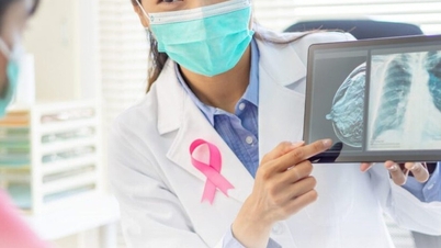 Hej läkare, jag frågar: Är det sant att unga människor inte får bröstcancer?