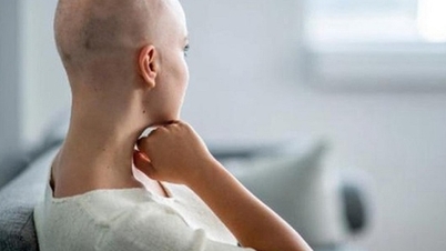 العناية بالشعر أثناء فترة إعادة نموه لدى مرضى السرطان