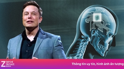 Компания Илона Маска имплантирует чип в мозг человека всего за 1,5 секунды.