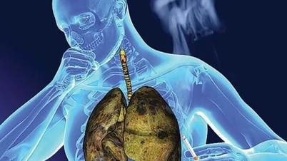 Ανάπτυξη συσκευών LoC για την υποβοήθηση της έγκαιρης ανίχνευσης καρκινικών κυττάρων του πνεύμονα.