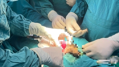 การรักษาอัณฑะที่บิดตัวในวัยรุ่นชายที่เลย "ช่วงเวลาทอง" สำหรับการฟื้นตัวของอัณฑะไปแล้วอย่างประสบความสำเร็จ