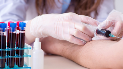 خون کے ٹیسٹ کی ضرورت کب ہے، اور کون سے عوامل ٹیسٹ کے نتائج کو متاثر کرتے ہیں؟