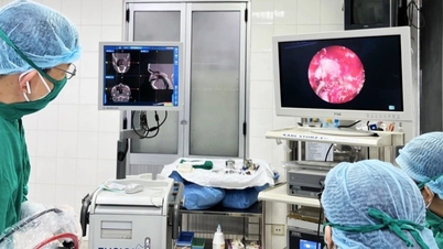 ທ່ານໝໍເປີດເຜີຍສາເຫດທີ່ການຜ່າຕັດທາງເດີນຫາຍໃຈເຂົ້າຊ່ອງດັງ 269 ຄັ້ງໃນນະຄອນໂຮ່ຈິມິນລົ້ມເຫຼວ.