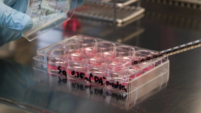 Tratamentul insuficienței cardiace severe prin transplant miocardic din celule iPS.