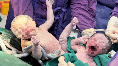 Rescatan a una mujer con preeclampsia y a sus hijos gemelos.