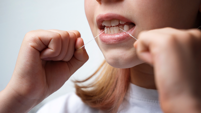 4 goede mondhygiënepraktijken voor patiënten met parodontitis.