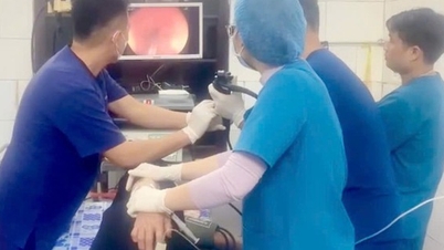 Nearly perforated the esophagus because of a pill.