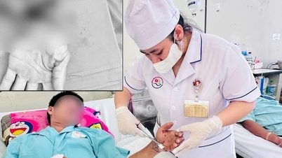 Успішне повторне пришивання відірваного зап'ястя: 8-годинна нічна мікрохірургія повністю відновлює тіло пацієнта.