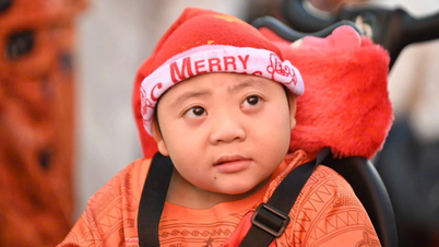 Ho Chi Minh şehrindeki bir hastanede bulunan "küçük savaşçılar" için Noel erken geldi.