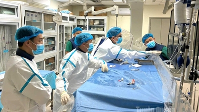 Ha Giang General Hospital successfully performed its first intervention, placing a flow-diverting stent to treat a brain aneurysm.
