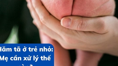 កន្ទួលកន្ទបចំពោះទារក៖ តើម្តាយគួរដោះស្រាយវាដោយរបៀបណា?