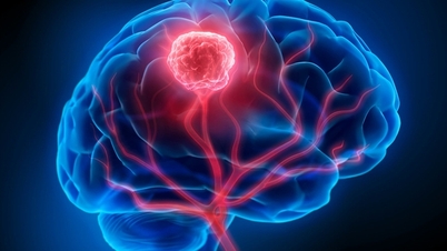 Thinking she had fainted due to a stroke, the 36-year-old woman was unexpectedly diagnosed with leukemia.