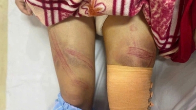 Seventh-grade girl allegedly abused: Was it because her piggy bank ran out of money?