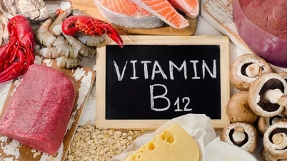 脳の健康を促進するビタミン B12 が豊富な食品は何ですか?